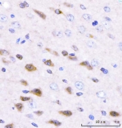 IHC staining of FFPE mouse brain tissue with Adgrg1 antibody. HIER: boil tissue sections in pH8 EDTA for 20 min and allow to cool before testing.