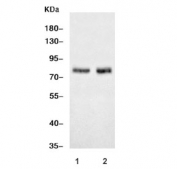 Western blot testing of 1) rat brain and 2) mouse brain tissue lysate with ADAM22 antibody. Predicted molecular weight: 91-100 kDa, commonly observed at 70-90 kDa.