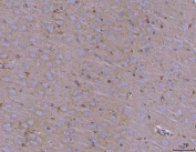 IHC staining of FFPE mouse brain tissue with ADAM22 antibody. HIER: boil tissue sections in pH8 EDTA for 20 min and allow to cool before testing.