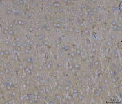 IHC staining of FFPE rat brain tissue with ADAM22 antibody. HIER: boil tissue sections in pH8 EDTA for 20 min and allow to cool before testing.
