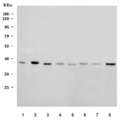Western blot testing of 1) human HepG2, 2) human HL60, 3) human 293T, 4) human Jurkat, 5) human RT4, 6) rat liver, 7) rat lung and 8) rat RH35 cell lysate with 17HSD7 antibody. Predicted molecular weight ~38 kDa.