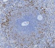 IHC staining of FFPE human spleen tissue with GZMK antibody. HIER: boil tissue sections in pH8 EDTA for 20 min and allow to cool before testing.