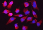 Immunofluorescent staining of FFPE human HeLa cells with RPL32 antibody (red) and DAPI nuclear stain (blue). HIER: steam section in pH6 citrate buffer for 20 min.