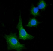 Immunofluorescent staining of FFPE human A549 cells with VPS53 antibody (green) and DAPI nuclear stain (blue). HIER: steam section in pH6 citrate buffer for 20 min.