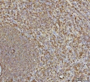IHC staining of FFPE human spleen tissue with VPS53 antibody. HIER: boil tissue sections in pH8 EDTA for 20 min and allow to cool before testing.