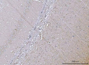 IHC staining of FFPE mouse brain tissue with VPS53 antibody. HIER: boil tissue sections in pH8 EDTA for 20 min and allow to cool before testing.