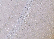 IHC staining of FFPE mouse brain tissue with VPS53 antibody. HIER: boil tissue sections in pH8 EDTA for 20 min and allow to cool before testing.