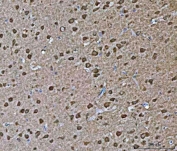 IHC staining of FFPE rat brain tissue with VPS53 antibody. HIER: boil tissue sections in pH8 EDTA for 20 min and allow to cool before testing.