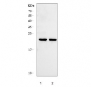 Western blot testing of human 1) HepG2 and 2) U-87 MG cell lysate with TNNI1 antibody. Predicted molecular weight ~22 kDa.