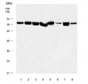 Western blot testing of 1) human HeLa, 2) human MCF7, 3) human HepG2, 4) human PANC-1, 5) rat liver, 6) rat brain, 7) mouse liver and 8) mouse brain tissue lysate with PDIA4 antibody. Predicted molecular weight ~73 kDa.