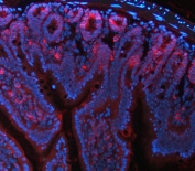 Immunofluorescent staining of FFPE mouse colon tissue with NKCC1 antibody (red) and DAPI nuclear stain (blue). HIER: steam section in pH8 EDTA buffer for 20 min.