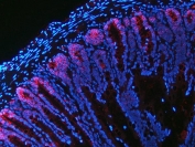 Immunofluorescent staining of FFPE rat colon tissue with NKCC1 antibody (red) and DAPI nuclear stain (blue). HIER: steam section in pH8 EDTA buffer for 20 min.