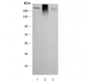 Western blot testing of human 1) A549, 2) Caco-2 and 3) PC-3 cell lysate with NKCC1 antibody. Expected molecular weight ~130 kDa but may be observed at higher molecular weights due to glycosylation.