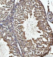 IHC staining of FFPE rat testis tissue with USP26 antibody. HIER: boil tissue sections in pH8 EDTA for 20 min and allow to cool before testing.