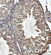 IHC staining of FFPE rat testis tissue with USP26 antibody. HIER: boil tissue sections in pH8 EDTA for 20 min and allow to cool before testing.