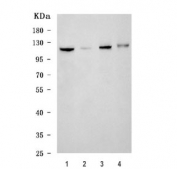 Western blot testing of 1) human HeLa, 2) rat heart, 3) rat liver and 4) mouse liver tissue lysate with USP26 antibody. Predicted molecular weight ~104 kDa.