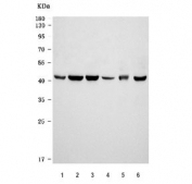 Western blot testing of 1) human HL60, 2) human ThP-1, 3) human MOLT4, 4) human U-937, 5) rat brain and 6) mouse brain tissue lysate with VPS36 antibody. Predicted molecular weight: 37-44 kDa (multiple isoforms).
