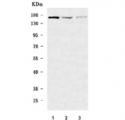 Western blot testing of human 1) HeLa, 2) 293T and 3) HT1080 cell lysate with DHX29 antibody. Predicted molecular weight ~155 kDa.