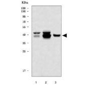 Western blot testing of 1) human HepG2, 2) human A549 and 3) rat liver tissue lysate with Retinol dehydrogenase 10 antibody. Predicted molecular weight ~38 kDa.
