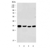 Western blot testing of 1) human HepG2, 2) human HeLa, 3) rat liver and 4) mouse liver tissue lysate with HSD17B8 antibody. Predicted molecular weight ~34 kDa.
