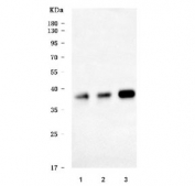 Western blot testing of human 1) K562, 2) PC-3 and 3) U-87 MG cell lysate with NRBF2 antibody. Predicted molecular weight ~32 kDa but commonly observed at 32-38 kDa.