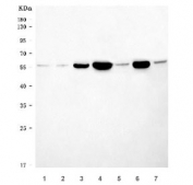 Western blot testing of 1) human 293T, 2) human HL60, 3) human MOLT4, 4) rat brain, 5) rat kidney, 6) mouse brain and 7) mouse kidney tissue lysate with B3GNT2 antibody. Predicted molecular weight ~46 kDa but may be observed at higher molecular weights due to glycosylation.