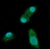 Immunofluorescent staining of FFPE human SiHa cells with YTH domain-containing protein 2 antibody (green) and DAPI nuclear stain (blue). HIER: steam section in pH6 citrate buffer for 20 min.