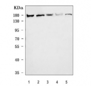 Western blot testing of 1) human Daudi, 2) huma HeLa, 3) human 293T, 4) rat C6 and 5) mouse NIH 3T3 cell lysate with YTH domain-containing protein 2 antibody. Predicted molecular weight ~160 kDa.