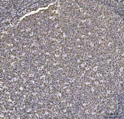 IHC staining of FFPE human tonsil tissue with HOXC4 antibody. HIER: boil tissue sections in pH8 EDTA for 20 min and allow to cool before testing.