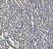 IHC staining of FFPE mouse kidney tissue with HOXC4 antibody. HIER: boil tissue sections in pH8 EDTA for 20 min and allow to cool before testing.