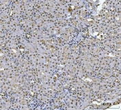 IHC staining of FFPE rat kidney tissue with HOXC4 antibody. HIER: boil tissue sections in pH8 EDTA for 20 min and allow to cool before testing.