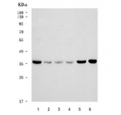Western blot testing of 1) human 293T, 2) monkey COS-7, 3) human U-87 MG, 4) human U-251, 5) mouse brain and 6) rat brain tissue lysate with TAAR6 antibody. Predicted molecular weight ~38 kDa.
