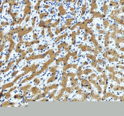 IHC staining of FFPE human liver tissue with ERGIC1 antibody, HRP-labeled secondary and DAB substrate. HIER: boil tissue sections in pH8 EDTA for 20 min and allow to cool before testing.
