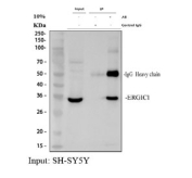 Immunoprecipitation of ERGIC1 protein from 500ug of human SH-SY5Y whole cell lysate with 2ug of ERGIC1 antibody.