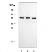 Western blot testing of human 1) U-251, 2) K562 and 3) ThP-1 cell lysate with SEPT5 antibody. Predicted molecular weight: 39-43 kDa (multiple isoforms).