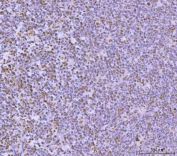 IHC staining of FFPE human tonsil tissue with GLIS1 antibody. HIER: boil tissue sections in pH8 EDTA for 20 min and allow to cool before testing.