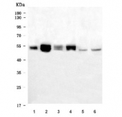 Western blot testing of 1) human placenta, 2) human HeLa, 3) human Jurkat, 4) human A549, 5) rat testis and 6) mouse testis tissue lysate with NDP52 antibody. Predicted molecular weight ~52 kDa.