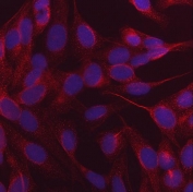 Immunofluorescent staining of FFPE human U-2 OS cells with NDP52 antibody (red) and DAPI nuclear stain (blue). HIER: steam section in pH6 citrate buffer for 20 min.