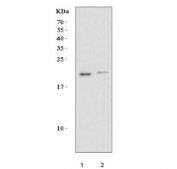 Western blot testing of human 1) SH-SY5Y and 2) A431 cell lysate with TOMM20-like protein 1 antibody. Predicted molecular weight ~18 kDa.