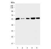 Western blot testing of mouse 1) EL-4, 2) spleen, 3) thymus, 4) RAW264.7 and 5) Ana-1 cell lysate with Pdcd1 antibody. Predicted molecular weight: 32-55 kDa depending on glycosylation level.