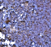 IHC staining of FFPE mouse thymus tissue with Pdcd1 antibody. HIER: boil tissue sections in pH8 EDTA for 20 min and allow to cool before testing.