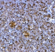 IHC staining of FFPE rat thymus tissue with Pdcd1 antibody. HIER: boil tissue sections in pH8 EDTA for 20 min and allow to cool before testing.