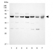 Western blot testing of 1) human HEK293, 2) human HeLa, 3) human HepG2, 4) human K562, 5) rat C6, 6) mouse brain and 7) mouse Neuro-2a cell lysate with SARS1 antibody. Predicted molecular weight ~59 kDa.