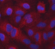 Immunofluorescent staining of FFPE human A549 cells with SARS1 antibody (red) and DAPI nuclear stain (blue). HIER: steam section in pH6 citrate buffer for 20 min.