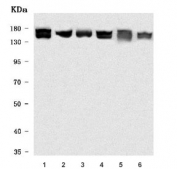 Western blot testing of 1) human HeLa, 2) monkey COS-7, 3) rat liver, 4) rat C6, 5) mouse liver and 6) mouse NIH 3T3 cell lysate with Rho-associated protein kinase 1 antibody. Predicted molecular weight ~158 kDa.
