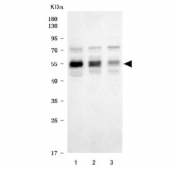 Western blot testing of human 1) HepG2, 2) 293T and 3) A431 cell lysate with X-ray repair cross-complementing 4 antibody. Predicted molecular weight: 35-38/55 kDa (unmodified/phosphorylated).