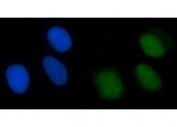 Immunofluorescent staining of FFPE human U-2 OS cells with X-ray repair cross-complementing 4 antibody (green) and DAPI nuclear stain (blue). HIER: steam section in pH6 citrate buffer for 20 min.