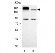 Western blot testing of human 1) HepG2 and 2) Jurkat cell lysate with TIMELESS antibody. Predicted molecular weight ~139 kDa.