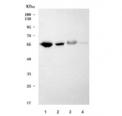 Western blot testing of 1) rat pancreas, 2) rat small intestine, 3) mouse pancreas and 4) mouse small intestine tissue with ADRA2A antibody. Predicted molecular weight ~49 kDa.