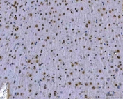 IHC staining of FFPE mouse brain with PSF antibody. HIER: boil tissue sections in pH8 EDTA for 20 min and allow to cool before testing.